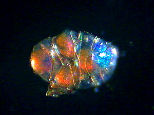 [tardigrade tardigrades eggs of Echiniscus sp. in cuticula]