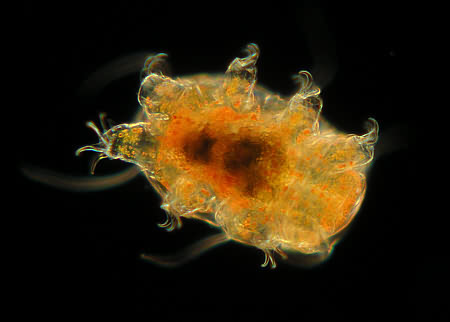 [ Echiniscus-B&auml;rtierchen ]