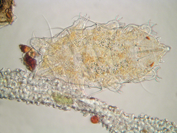 [ Heterotardigrade from the Canary islands ]