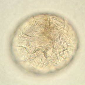 [Milnesium tardigradum, Ei]