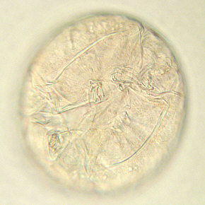 [Milnesium tardigradum, Ei]
