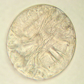 [Milnesium tardigradum, Ei]