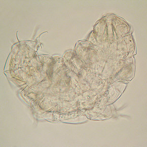 [Milnesium tardigradum, 1. Tag]