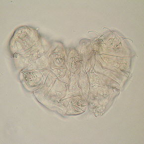 [Milnesium tardigradum, 1. Tag]