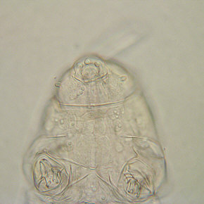 [Milnesium tardigradum, 1. Tag]