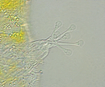 [ Batillipes tardigrade, toe with adhesive discs ]