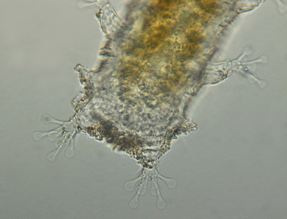 [ Batillipes from Pag Island: hind part of body ]