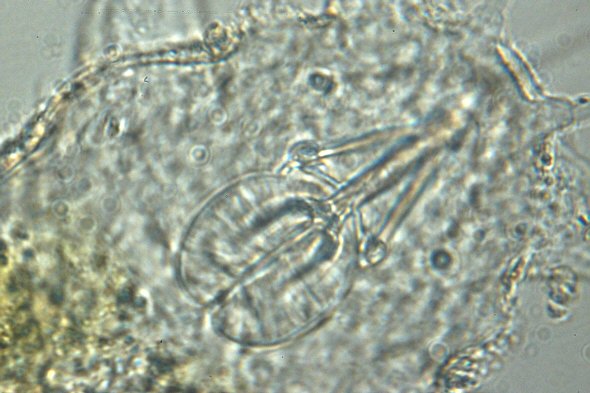 [ Batillipes from Pag Island: pharyngeal apparatus ]