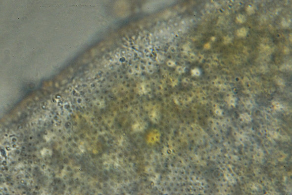 [ Batillipes from Pag Island: cuticula (2)]