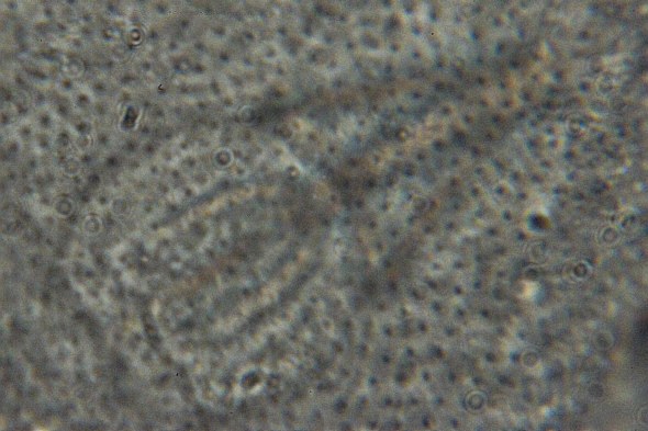 [ Batillipes from Pag Island: cuticula (4) ]