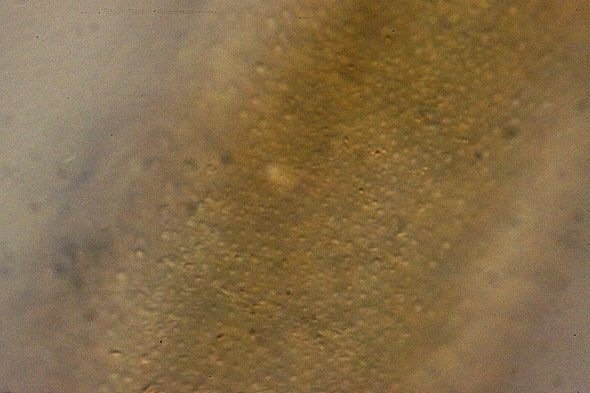 [ Batillipes from Pag Island: cuticula (3) ]