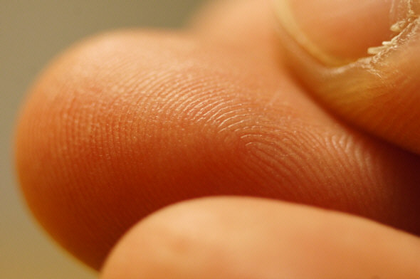 [ Photomicrograph, made by means of a Sony Nex-5N camera equipped with a Hexanon macro objective ]