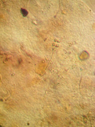 [ Tardigraden: Darminhalt eines Milnesium-B&auml;rtierchens ]