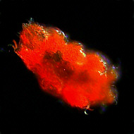 [Echiniscus]