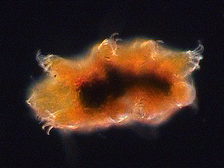 [Bärtierchen-Mikrofoto]