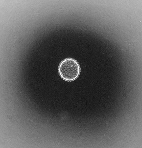 [ Optimierung der Dunkelfeldeinstellung ]