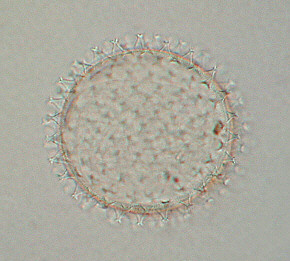 [ tardigrade tardigraden ei]