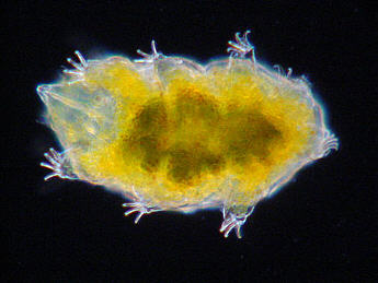 [ Echiniscus-B&auml;rtierchen ]