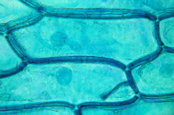 [ Zellen in der Zwiebelhaut ]