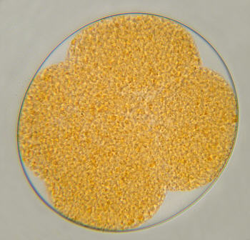 [ B&auml;rtierchen(Echiniscen)-Ei, Vierzellenstadium, Zellteilung ]