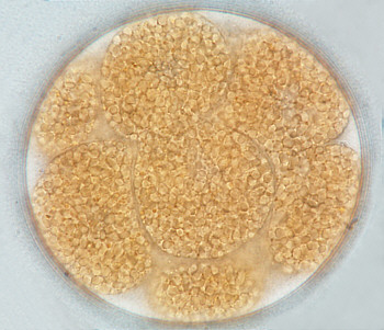 [ B&auml;rtierchen(Echiniscen)-Ei, Achtzellenstadium, Zellteilung ]