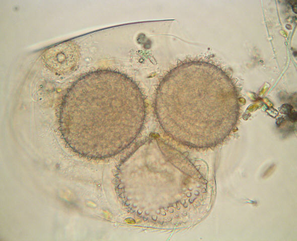 [ Dactylobiotus dispar, Tardigrade, Totale ]