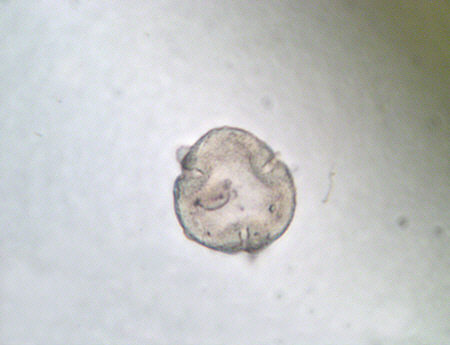 [ Moos-Herbar des Fraters Erhard, Pollen vom Einzelblatt "Grimmia pulvinata" ]