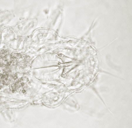 [ Batillipes tardigrade, head region ]