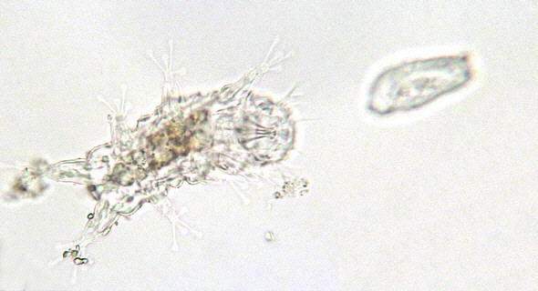 [ Batillipes tardigrade, total view ]