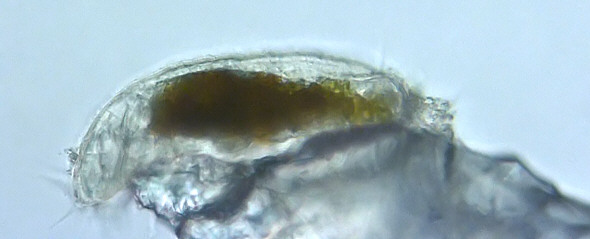 [ Batillipes mirus on sand grain ]