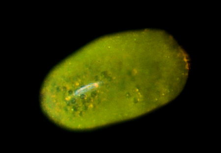 [ Echiniscus tardigrade: disposed stomach/intestine contents ]