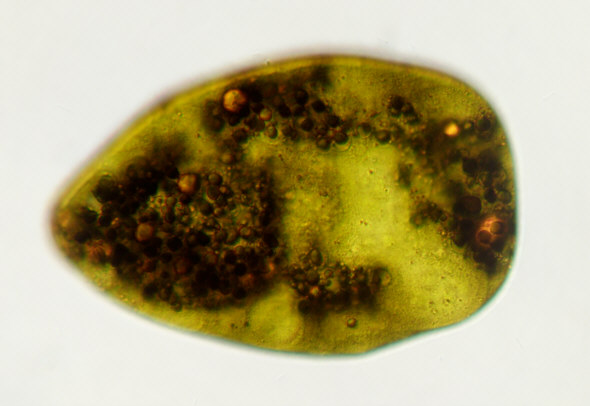 [ Echiniscus tardigrade: disposed stomach/intestine contents ]