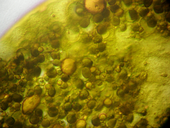 [ Echiniscus tardigrade: disposed stomach/intestine contents ]