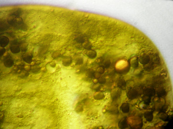 [ Echiniscus tardigrade: disposed stomach/intestine contents ]