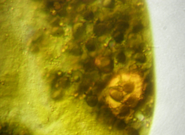 [ Echiniscus tardigrade: disposed stomach/intestine contents ]