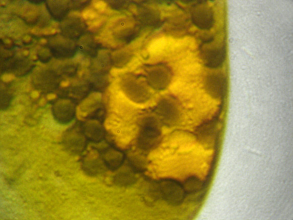 [ Echiniscus tardigrade: disposed stomach/intestine contents ]