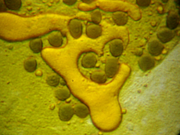 [ Echiniscus tardigrade: disposed intestine/stomach contents ]