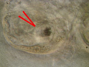 [tardigrades, B&auml;rtierchen]