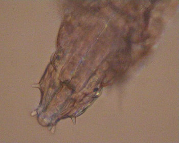 [tardigrades, B&auml;rtierchen]