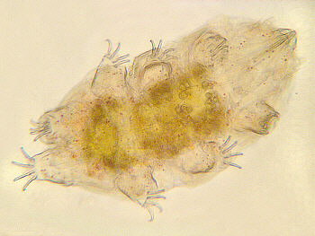 [tardigrades]