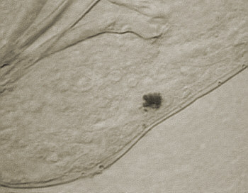 [tardigrades, B&auml;rtierchen]