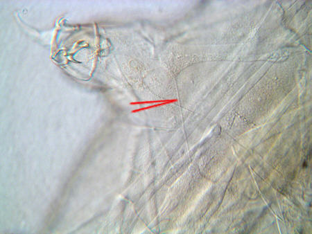 [ Tardigrada, tardigrades; nerve-muscle joint ]