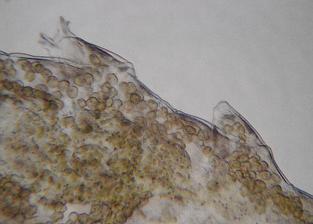 [ B&auml;rtierchen (Tardigrada), Behinderungen ]