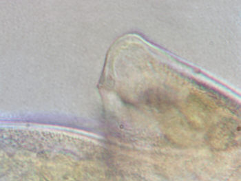 [ B&auml;rtierchen (Tardigrada), Behinderungen ]