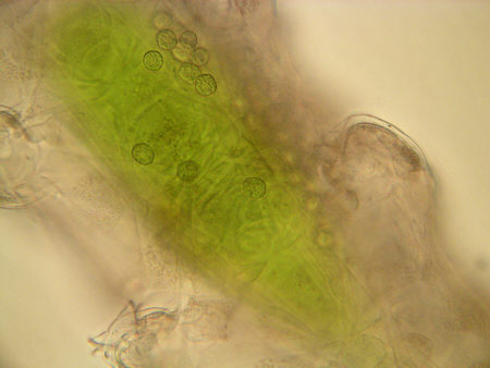 [ B&auml;rtierchen (Tardigrada), Behinderungen ]