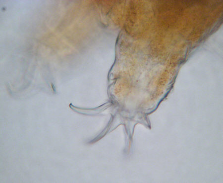 [ B&auml;rtierchen (Tardigrada), Behinderungen ]