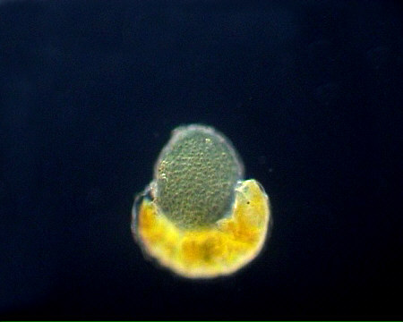 [ tardigrade playing (?) with alga ]