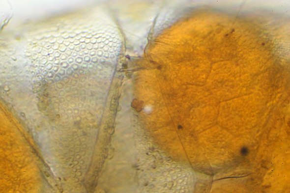 [ tardigrade exuvium with eggs ]