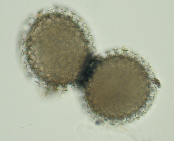 [ BUGA tardigrade eggs ]