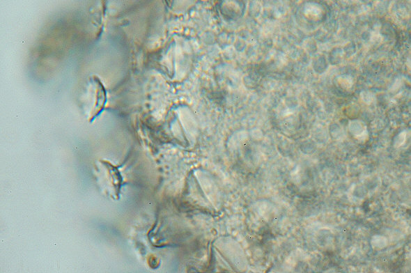 [ BUGA tardigrade egg, detail ]